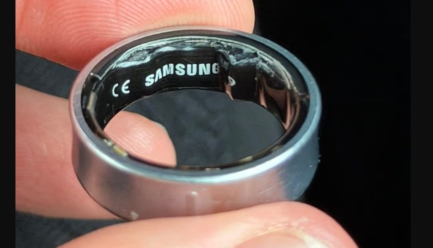 perdoruesi-i-samsung-galaxy-ring-shkon-ne-spital-dhe-nuk-lejohet-te-hipe-ne-fluturim-pasi-bateria-e-unazes-fillon-te-fryhet