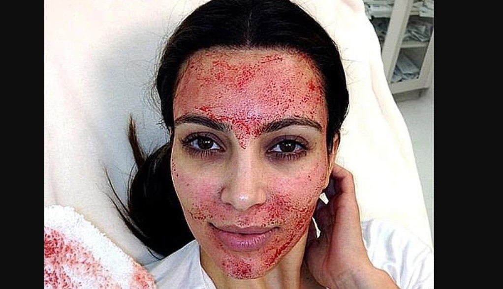 trendi-i-cuditshem-i-kujdesit-per-lekuren-maska-menstruale-grate-vendosin-gjakun-e-menstruacioneve-ne-fytyre-por-a-eshte-i-shendetshem