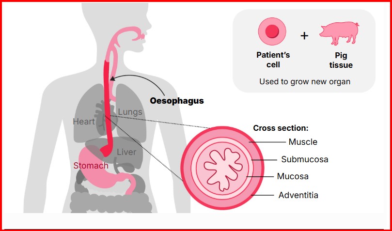 ezofag-i-krijuar-ne-laborator-jep-shprese-per-femijet