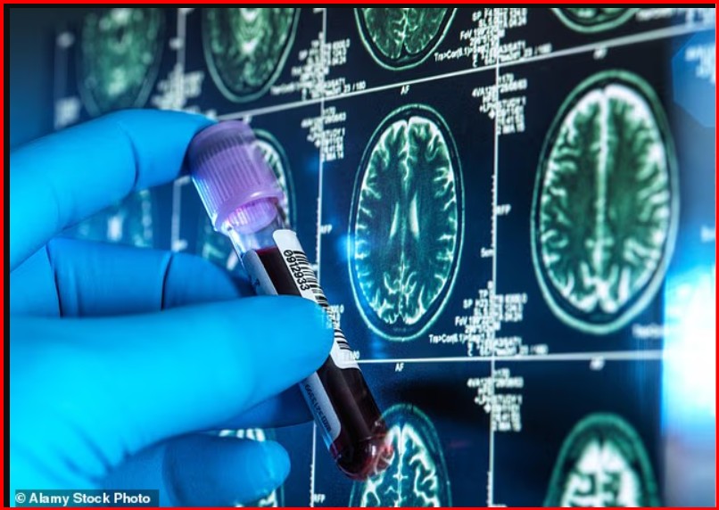 test-i-ri-i-gjakut-mund-te-zbuloje-ndryshimet-e-alzheimerit-10-vjet-para-shfaqjes-se-simptomave